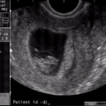 echo-20061114-1.jpg