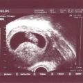 echo-20061122.jpg