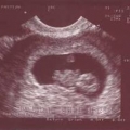 echo-20061125-1.jpg