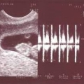 echo-20061125-2.jpg