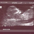 echo-20061211-1.jpg