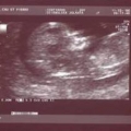 echo-20061211-2.jpg