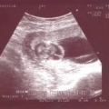echo-20061226-1.jpg