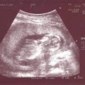 echo-20061226-2.jpg