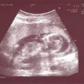 echo-20061226-3.jpg