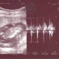echo-20061226-4.jpg