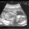 echo-20070122-1.jpg