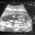 echo-20070122-3.jpg
