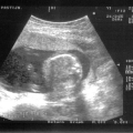 echo-20070122-4.jpg