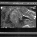echo-20070214-1.jpg