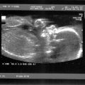 echo-20070214-2.jpg