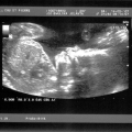 echo-20070214-3.jpg