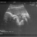 echo-20070507-1.jpg
