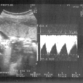 echo-20070507-2.jpg