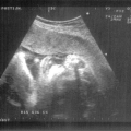 echo-20070507-3.jpg