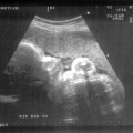 echo-20070507-4.jpg