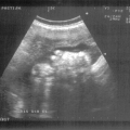 echo-20070522-1.jpg