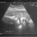 echo-20070522-2.jpg