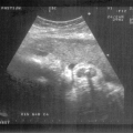 echo-20070522-3.jpg